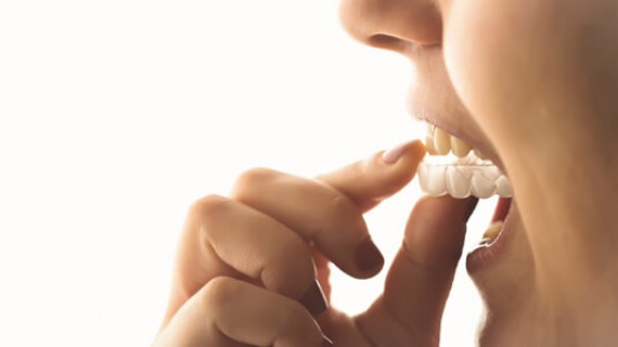 Teeth Grinding Splints