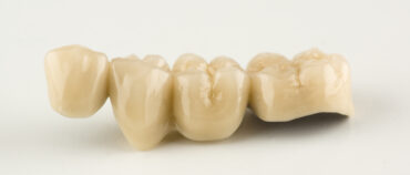 What Is A Dental Bridge? Understanding How They Work
