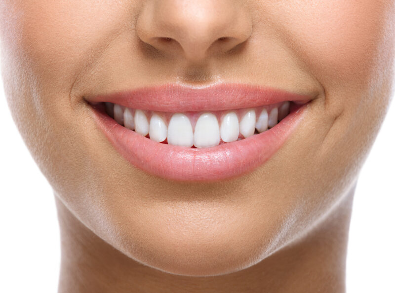 What Is Cosmetic Dentistry?