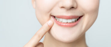 All-on-4 vs All-on-X Dental Implants