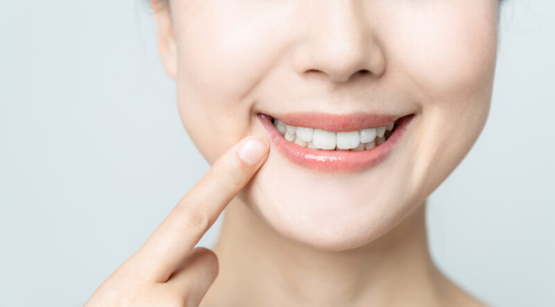 All-on-4 vs All-on-X Dental Implants
