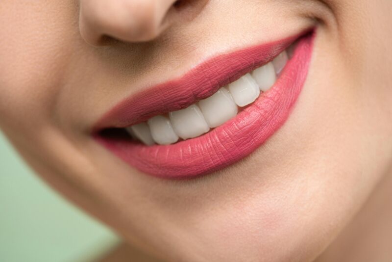 Does Teeth Whitening Actually Work?